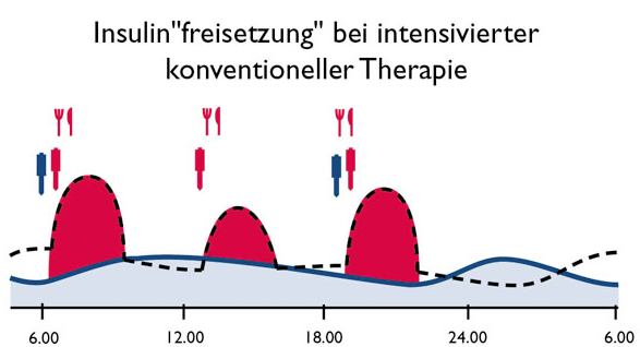 Insulinfreisetzung bei intensivierter konventioneller Therapie (ICT) Eine moderne Art der Insulintherapie, bei der durch mehrere Insulininjektionen und Blutzuckerkontrollen pro Tag versucht wird, die Stoffwechselsituation von gesunden Menschen möglichst gut nachzuahmen. Die Essenszeiten und Mengen können frei bestimmt werden.